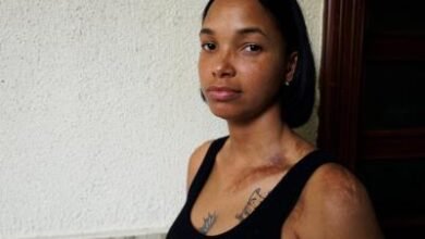 Photo of Yoselin Sánchez, víctima de intento de feminicidio pide justicia