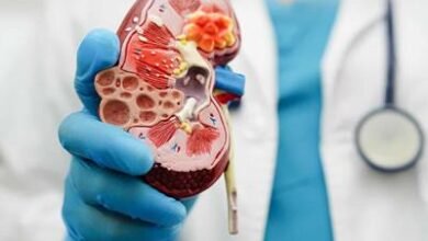 Photo of Enfermedad renal crónica: novena causa de muerte en el mundo