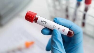 Photo of OPS desmiente rumores sobre epidemia de VIH en RD