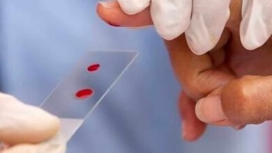 Photo of Hemofilia en República Dominicana supera 570 personas