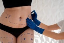 Photo of Someterse a procedimientos en una cirugía estética está permitido