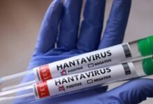 Photo of La OMS eleva a 11 los casos de hantavirus