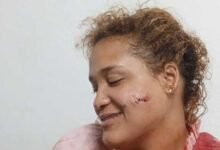 Photo of Violencia de género: mujer es agredida por su pareja en Puerto Plata