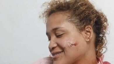 Photo of Violencia de género: mujer es agredida por su pareja en Puerto Plata